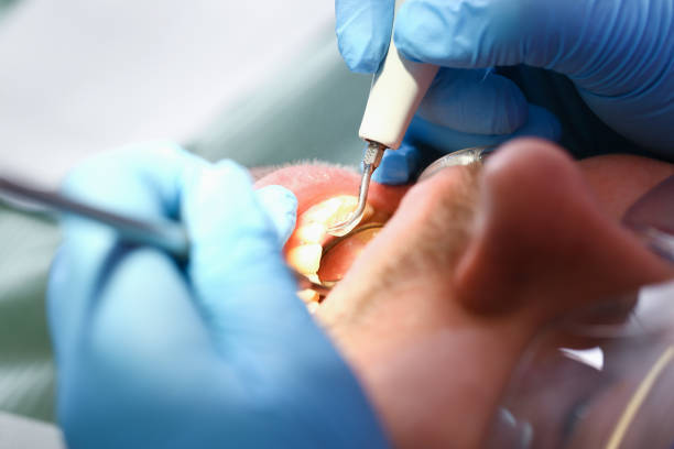 Best Emergency Broken Tooth Repair in Enfield, NC